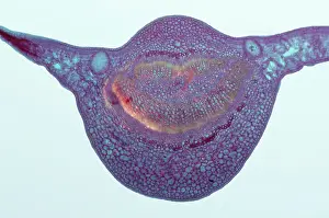 Globulus: Light Micrograph (LM): A transverse section of