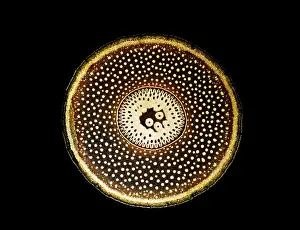 Pandanus: Light Micrograph (LM): A transverse section of