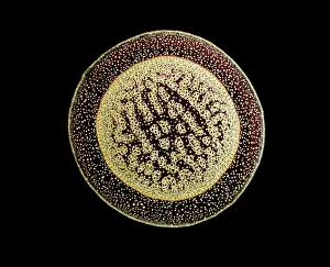 Pandanus: Light Micrograph (LM): A transverse section of