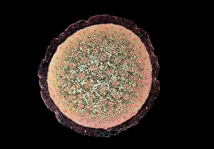 Aculeatus: Light Micrograph (LM): A transverse section of