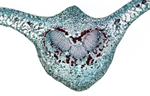 Cherries: Light Micrograph (LM): A transverse section of