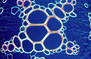 Transverse: Light Micrograph (LM): A transverse section of