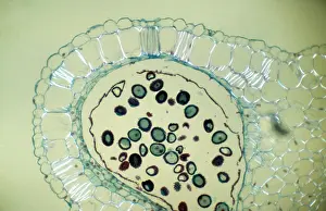 Anther: Light Micrograph (LM): Transverse section of Dehiscence
