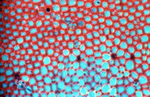 Tissue: Light Micrograph (LM): transverse section shows