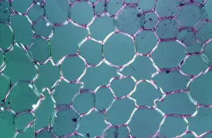 Packing: Light Micrograph (LM): tranverse section shows