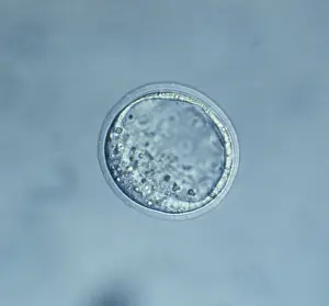 Microscope: Light Micrograph of Mouse Blastocyst