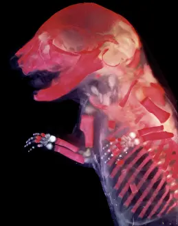 Embryos: Light Micrograph of Mouse Embryo - red dye to show bones