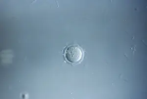 Sperm: Light Micrograph of Mouse Ovum being fertilized