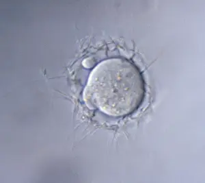 Sperm: Light Micrograph of Mouse Ovum being fertilized