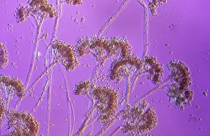 Produces: Light Micrograph: Penicillin, The Penicillium mould
