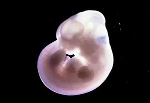 Fertilisation: Light Micrograph of Rat Embryo 13.2 days after fertilisation
