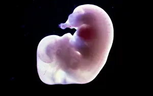 Embryos: Light Micrograph of Rat Embryo at 14.5days old