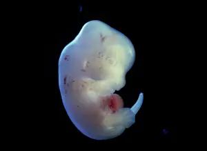 Embryos: Light Micrograph of Rat Embryo - at 15.5 days
