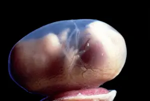Embryos: Light Micrograph of Rat Embryo - 15.5 days into