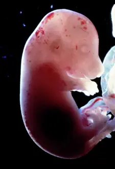 Embryos: Light Micrograph of Rat Embryo without its yolk