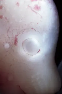 Embryos: Light Micrograph of Rat Embryo without its yolk