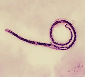 Dae Sasitorn And David Spears: Light Micrograph (SEM): Micro-filarial worm