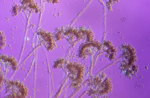 Mould: Light Micrograph showing fruiting bodies (conidiophores)