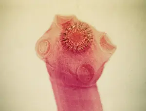 Dae Sasitorn And David Spears: Light Micrograph: Tapeworm