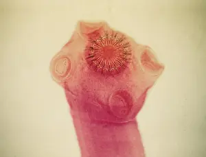 Micrographs: Light Micrograph: Tapeworm
