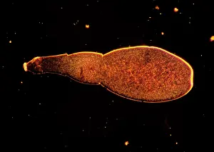 Micro: Light Micrograph: Tapeworm