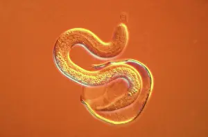 Micro: Light Micrograph using Nomarski Technique: Intestinal