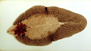 Flatworm: Liver Fluke, microscope slide preparation of the