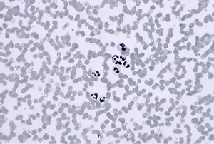 Mosquito: Malarial Parasite Mosquito - Erythrocytic stage x 100