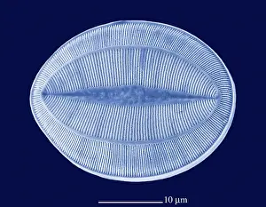 2500: Microalga - the micro-algae have very graphic forms. x 2500