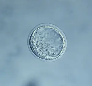 Sperm: Mouse Blastocyst