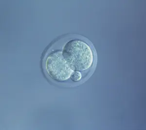 Sperm: Mouse Embryo at Two Cell Stage & a Polar Body