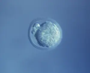 Sperm: Mouse Embryo at Single Cell Stage and Polar Body