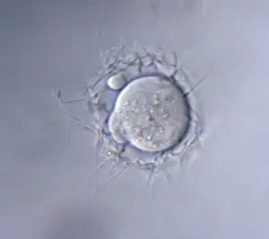 Sperm: Mouse Ovum being fertilized