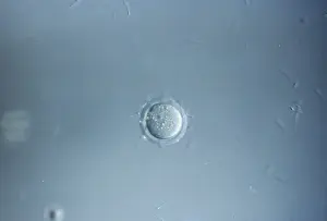 Micro: Mouse Ovum being fertilized