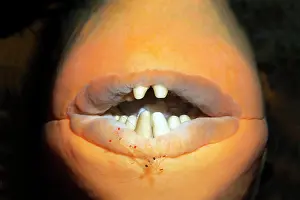 Prawn: Mouth, teeth, yellow triggerfish (Pseudobalistes