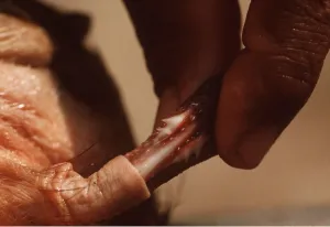Hands: PACA - Close-up of male's penis and spines