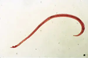 Worms: Parasitic nematode WORM / Flatworm (X10 magnification)
