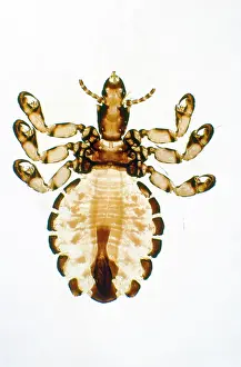 Lice: Pig Louse - x5 magnification