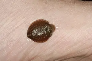 Annelid: Leech