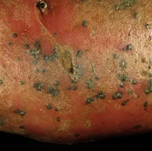 Lesions: Potato skin spot lesions