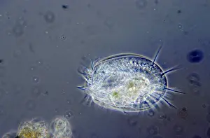 Patella: Protist (Euplotes patella) close up of single p