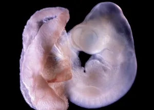 Fertilisation: Rat Embryo 11.5 days after fertilisation