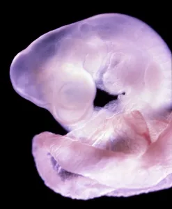Micro: Rat Embryo 11.5 days after fertilisation