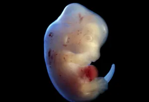 Lifecycle: Rat Embryo at 15.5 days, no sac, no placenta