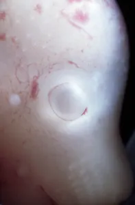 Lifecycle: Rat Embryo without its yolk sac, at 17.5 days