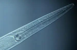 Microscopic: Roundworm over 15, 000 known species in the genu