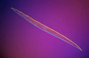 Microscopic: Roundworm over 15, 000 known species in the genu