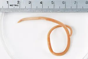 Roundworm: RoundWORM - From Cat