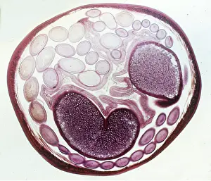 Worms: ROUNDWORM -T.Section of horse roundworm