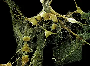 Micro: Scanning Electron Micrograph (SEM)